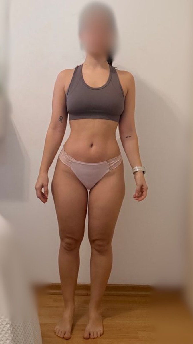 Transformación de Melanie
